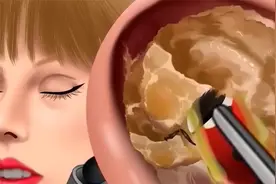 天呐！小姐姐的耳朵怎么成这样了视频封面