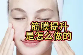 筋膜提升是怎么做的、筋膜提拉术能维持多久、了解下吧~视频封面