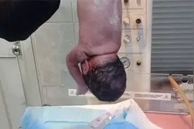 医生将新生儿倒立起来，用力拍打后背，竟救了他一命