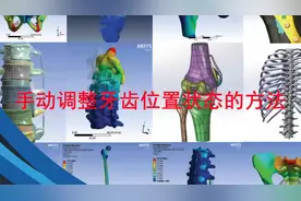 口腔正畸手动调整牙齿位置的方法.