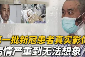 第一批新冠患者全身溃烂，病情严重到无法想象，20年武汉真视频封面