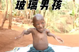 原始部落玻璃男孩医院治疗无效，被学校劝退，和妈妈相依为命...视频封面