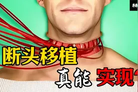 断头移植真的能实现吗？视频封面