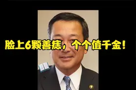 脸上6颗善痣，个个值千金！视频封面