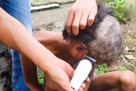 可怜的流浪男人头发上长满虱子，好在有好心人及时救助视频封面