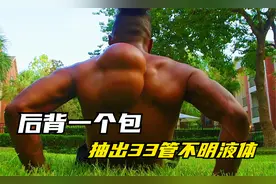 黑人小哥后背长了一个巨大的青春痘，抽出了33管黄色液体.视频封面