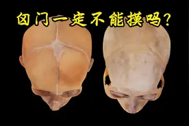 天门盖（囟门）被摸了会怎样呀？在线等视频封面