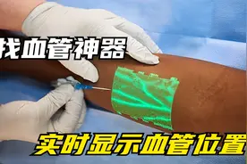 黑科技血管透视仪，能照遍身体上的血管，让护士打针百发百中视频封面