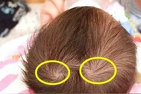 孩子头上有“2个旋”？知道这代表着什么吗？很多父母都无知了图片