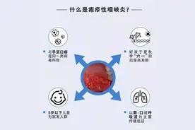 疱疹性咽峡炎，孩子该如何预防？图片