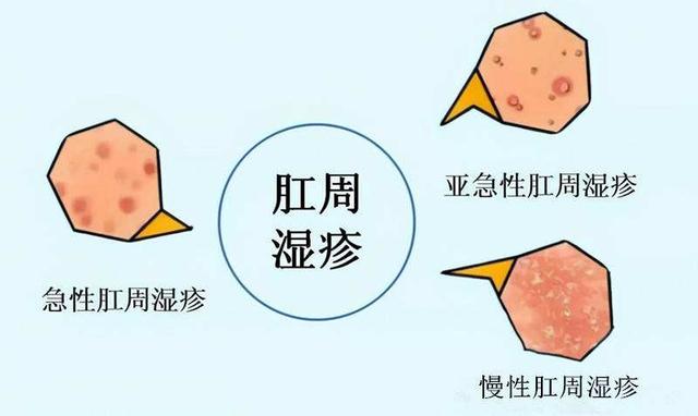 发病与内外多种因素有关手部湿疹的常见症状包括皮肤损伤和皮肤瘙痒