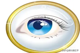 眼睛为什么会有白内障，了解白内障的几种病因图片