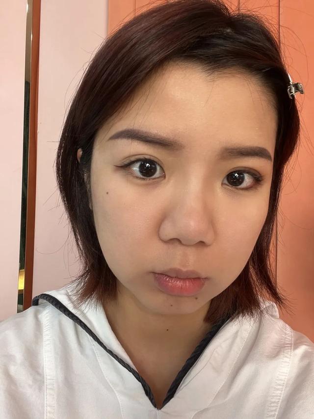 鼻子肉多怎么办