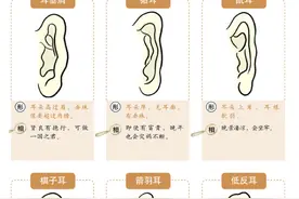 “穷人耳”“富人耳”有没有科学依据？自检你属于哪种类型的耳朵图片