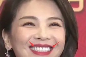 假发假牙假腹肌，连屁股都是假的，明星们的“小秘密”藏不住了图片