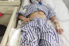 被姐夫投毒百草枯的女孩换肺成功！苏醒后微笑面对镜头比“耶”图片