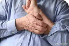 再厉害的湿疹 皮肤瘙痒，也怕这10种中成药，便宜好用，医生都在用图片