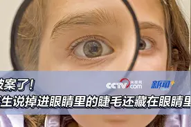 破案了！医生说掉进眼睛里的睫毛还藏在眼睛里图片