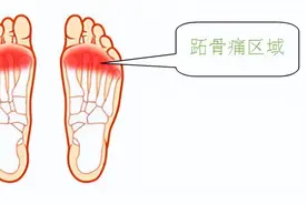 走路时前脚掌痛？警惕“跖痛症”图片