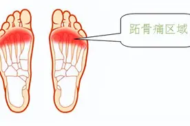 走路时前脚掌痛？警惕“跖痛症”图片