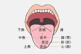 中医舌诊系列之常见异常舌象有哪些？图片