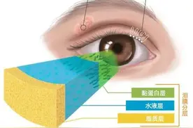 视百年眼科丨经常流泪，也有可能是干眼吗？图片
