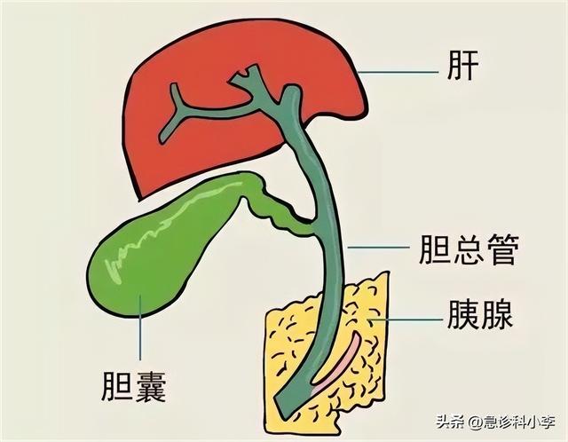 急性胆囊炎有哪些明显症状？如何避免急性胆囊炎？