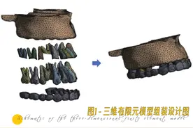 文献干货｜矫治器联合微种植体内收并压低上前牙的三维有限元分析图片