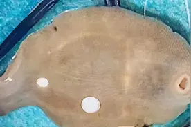 广西女子的肝脏被吃掉1/3，祸根是鱼腥草？它真的伤肾致癌吗？图片