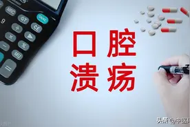 口腔溃疡 脸上长疮，吃维生素管用吗?医生教你：对症调理图片