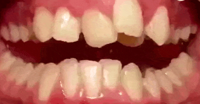 ҽرǿݽ⼸һҪע⣡