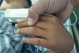 银环蛇一口，抢救十小时都够呛啊！图片