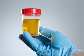 腰不痛、腿不酸，出现血尿不用慌？辟谣：泌尿科医师说出了真相图片