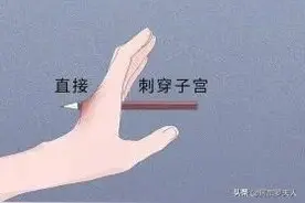 “节育环”在女性体内可能会发生哪些变化？请认真看完（漫画）图片
