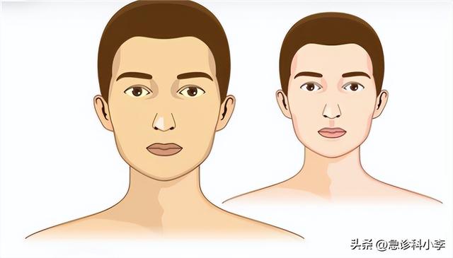 急性胆囊炎有哪些明显症状？如何避免急性胆囊炎？