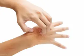 体内有癌，手指先知？提醒：手指出现这些症状，可能是疾病的信号图片