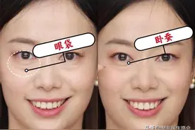 眼袋、卧蚕分不清楚？看完这篇文章你绝对能区分的明明白白图片
