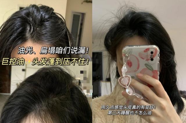 孕期还跟风乱用洗发水？阿道夫脱发不控油，飘柔控油但长头屑