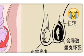 好痛！8岁男孩蛋蛋扭转360度，颜色都黑了，医生火速救治图片