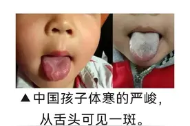 当下，本属“纯阳之体”的孩子何以虚寒至极？图片