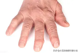 布洛芬是常用的止痛药、退烧药，有副作用吗？有哪些人不宜服用？图片