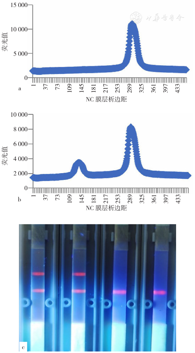 基于量子点标记技术的免疫层析法检测新型冠状病毒N蛋白IgG抗体研究