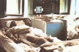 日本核辐射有多恐怖？男子被辐射后看着自己融化，83天堪比凌迟图片