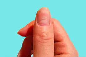 你知道为什么指甲上会出现分层、波浪和皱纹吗？如何轻松预防图片