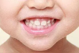 孩子这样笑，居然也是一种病！家长想要提前干预得这么做图片