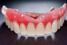 【健康小课堂】牙齿修复知多少图片