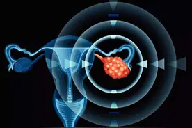 卵巢恶性肿瘤止痛治疗措施图片