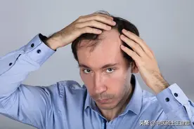 脱发严重，再也不用怕！医生教你简单四招，正确搞定掉头发图片