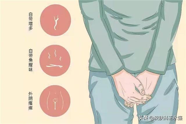 宫颈癌非角化性