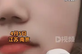 男子钓鱼甩杆鱼钩扎进妻子脸，伤口冒血，女方表情淡定不怪老公：没哭，不如省点力气去医院，他也不是故意的图片